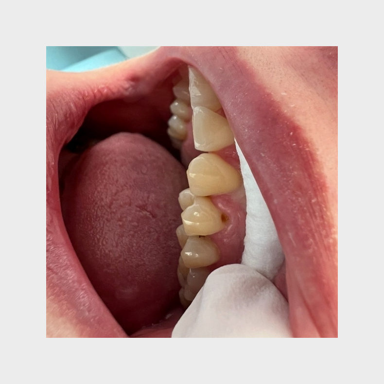 Hands-on plastkursus for tandplejere &amp; tandklinikassistenter 